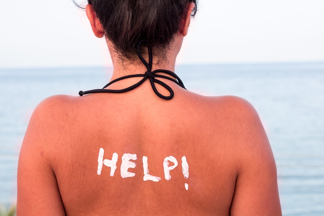 Woman with "HELP!" written on her back - Remedies for sunburn