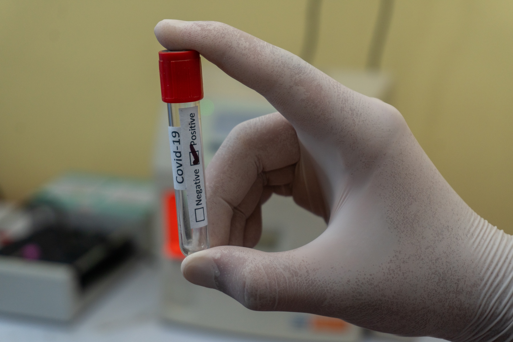 resultados test PCR